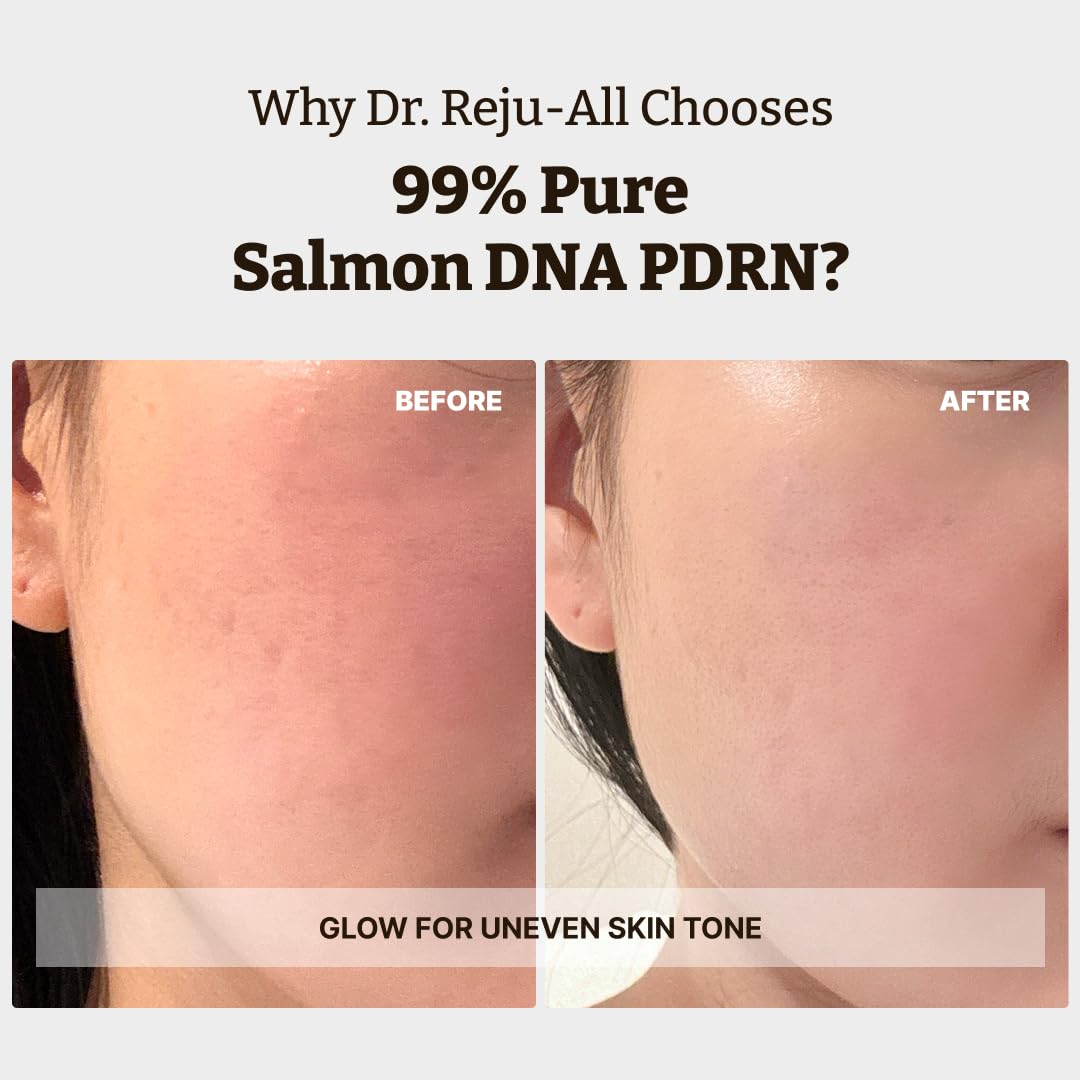 Rejuall Advanced PDRN Repair Cream 20g – Korean Skin Regeneration