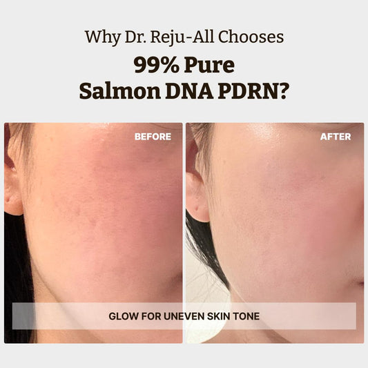 Korean Skincare: Rejuall Advanced PDRN Repair Cream